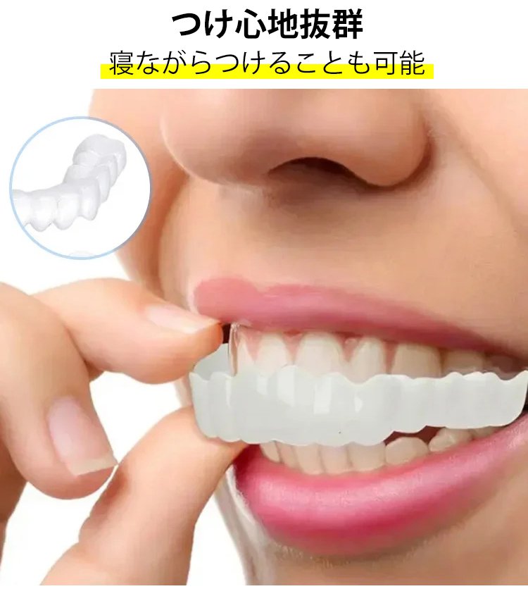 🔥HOT SALE!⏰ Magic Smile Teeth Brace